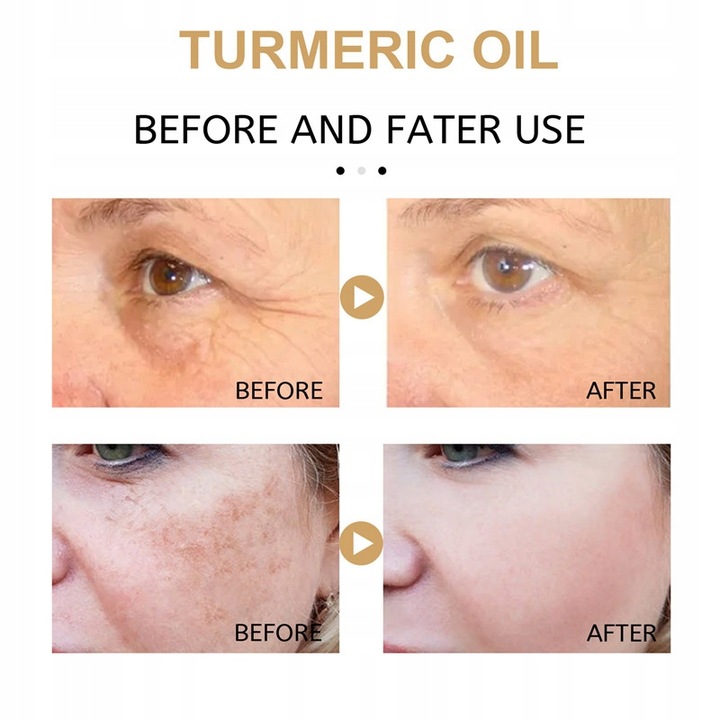 Turmeric-Essential-Oil-Organic-Tumeric-Oil-For-Marka-Oneofthose Turmeric-Essential-Oil-Organic-Tumeric-Oil-For-Marka-Oneofthose
